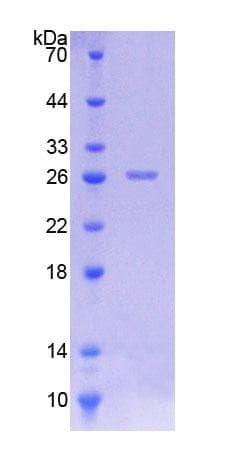 Rat CASP8 / Caspase 8 Protein (Recombinant His-T7)
