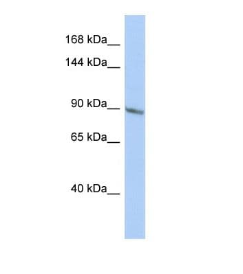 TBC1D2B Antibody (aa401-450)