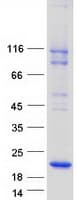 Human MARVELD1 Protein (Recombinant Myc-DDK (Flag))