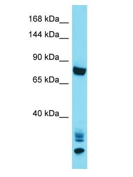 Polyclonal Rabbit anti-Human ANKRD36 Antibody (aa1627-1676, WB)