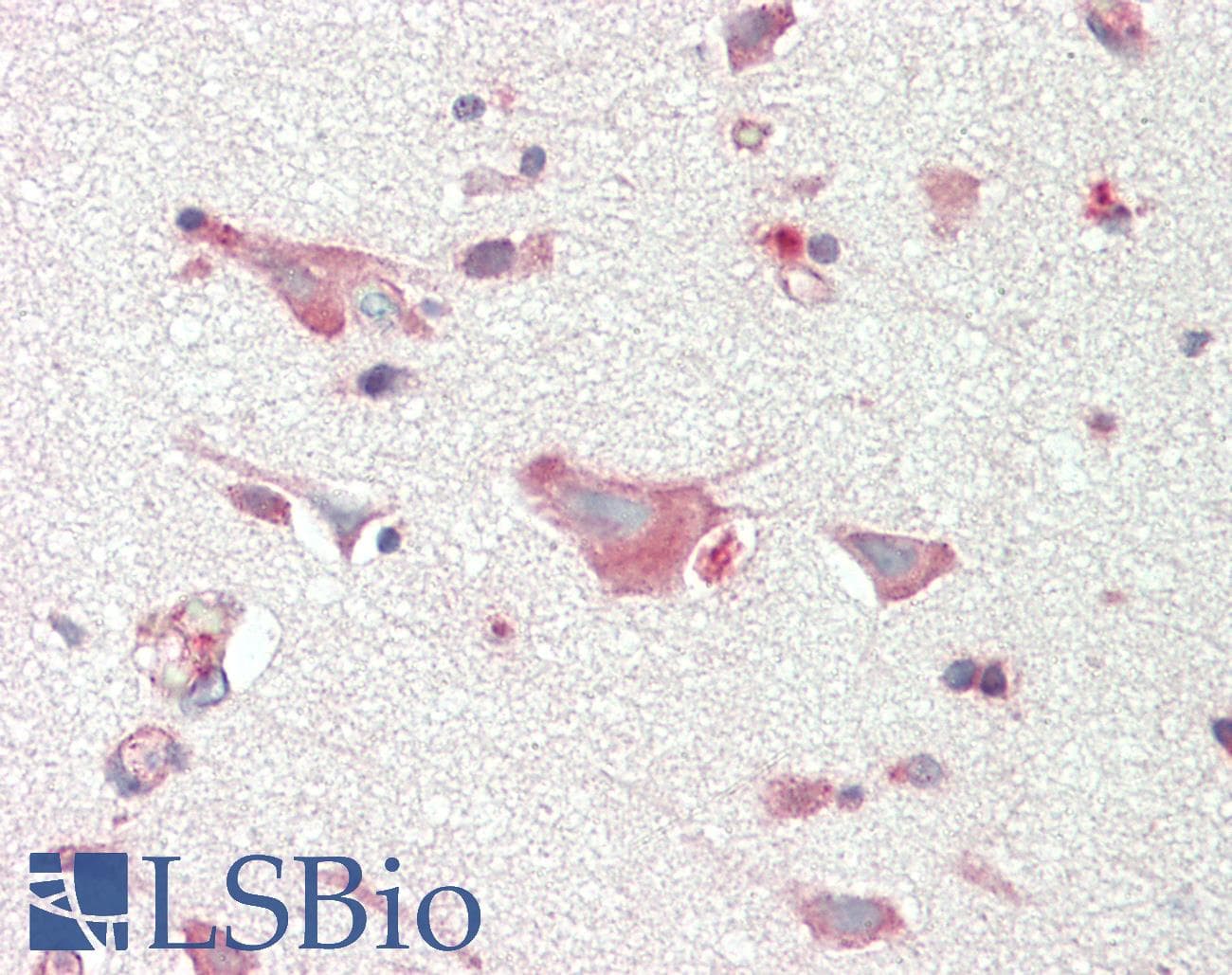 IHC-plus™ Polyclonal Rabbit anti-Human CLDN5 / Claudin 5 Antibody (aa171-220, IHC, IF, WB)