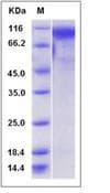 Mouse GPNMB / Osteoactivin Protein (Recombinant His,C-terminus)