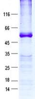 Human RPL5 / Ribosomal Protein L5 (Recombinant GST, N-terminus + His, C-terminus)