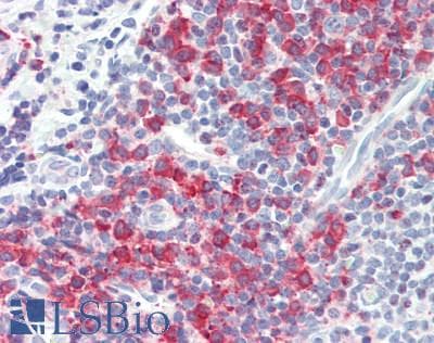 IHC-plus™ TXK / RLK Antibody (Internal)