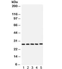 SRSF1 / SF2 Antibody