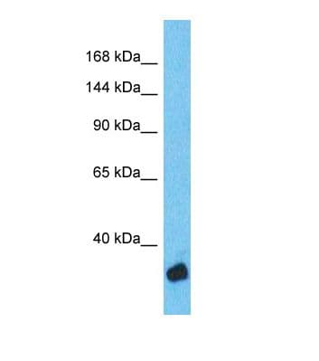 ZNF134 Antibody (aa111-160)