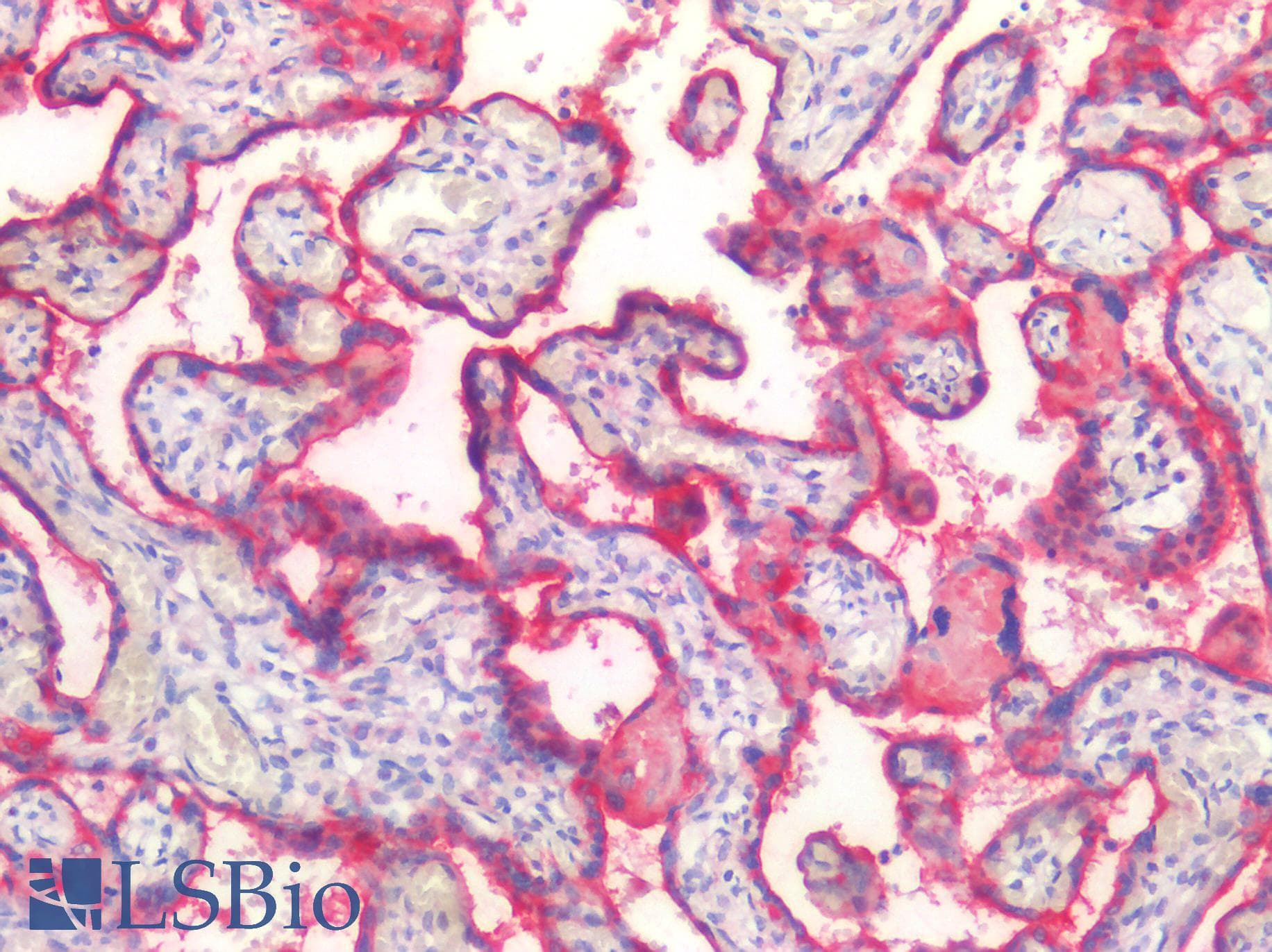 PathPlus™ Monoclonal Mouse anti-Human CD71 / Transferrin Receptor Antibody (clone H68.4, aa3-28, IHC, IF, WB)