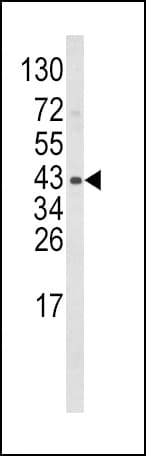 Polyclonal Rabbit anti-Human WNT5B Antibody (aa153-182, IHC, WB)