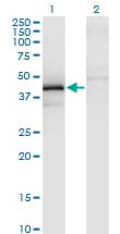 ZFYVE19 Antibody (clone 3G4-2B11)