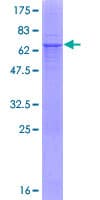 Human CA12 / Carbonic Anhydrase XII Protein (Recombinant GST)