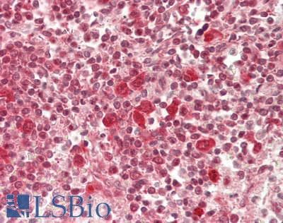 IHC-plus™ RNF182 Antibody (aa1-30)