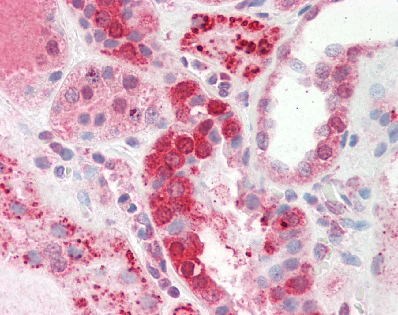 CTDSP2 Antibody (C-Terminus)