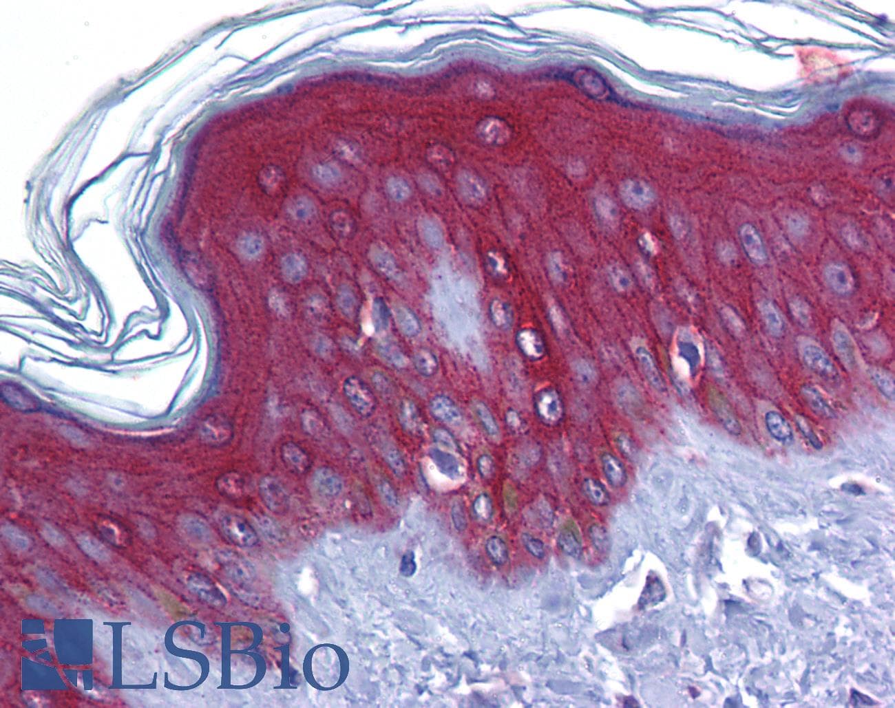 IHC-plus™ JUP/CTNNG/Junction Plakoglobin Antibody (aa696-745)