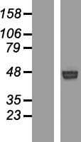 ROR1 Protein (Over-Expression Lysate Myc-DDK (Flag))