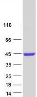 Human REM1 / REM-1 Protein (Recombinant Myc-DDK (Flag))