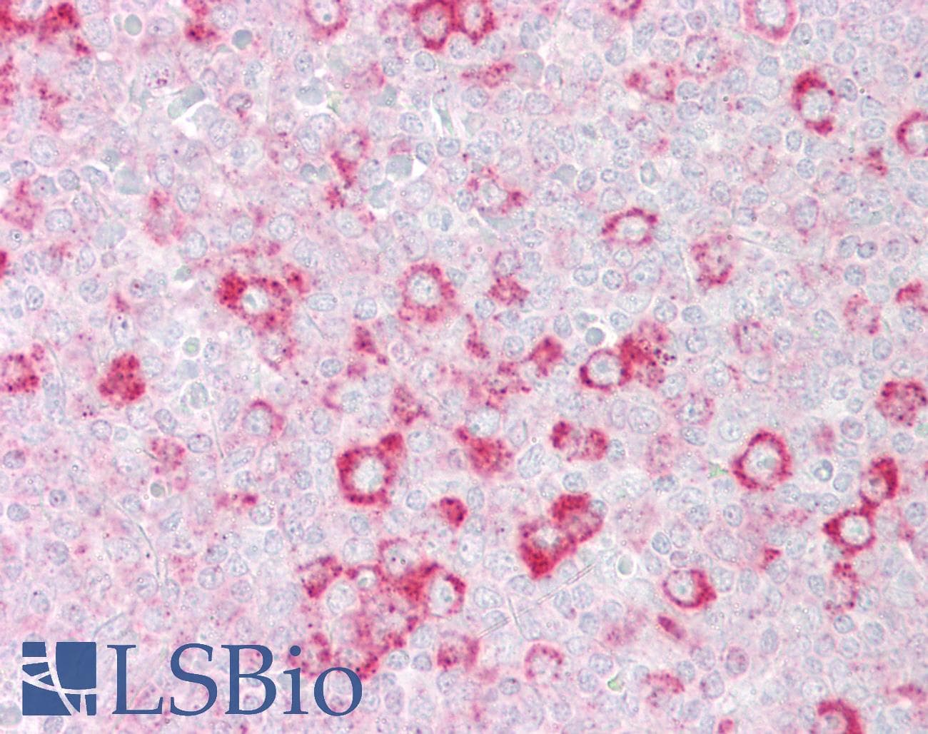 RHOD Antibody (C-Terminus)