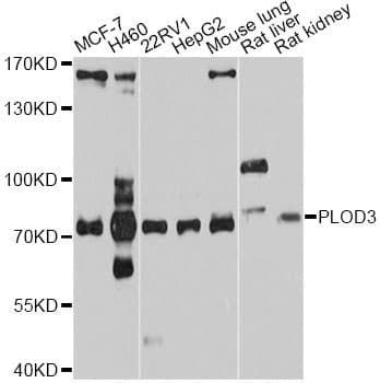 PLOD3 Antibody