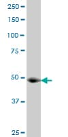 KAT2A / GCN5 Antibody (clone 3F8)