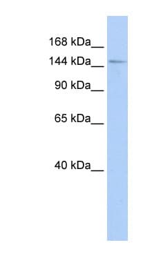 PPIP5K2 / HISPPD1 Antibody (aa611-660)