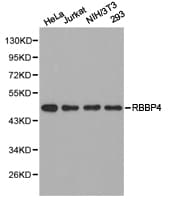 Polyclonal Rabbit anti-Human RBBP4 / RBAP48 Antibody (IHC, WB)