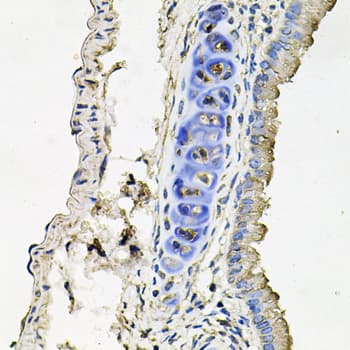 IHC-plus™ SLC39A4 / ZIP4 Antibody