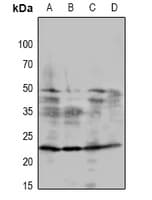 RCAN1 / DSCR1 Antibody