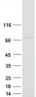 Human NUPL1 Protein (Recombinant Myc-DDK (Flag))