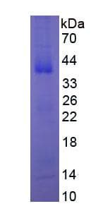 Human NGF Protein (Recombinant His, N-Terminal)