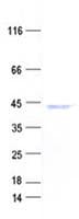 Human ACPP / PAP Protein (Recombinant His, N-Terminal)