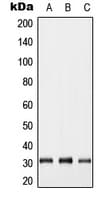 GJB5 / CX30.1 / Connexin 31.1 Antibody (Internal)