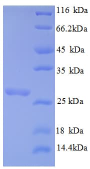 Mouse BCL2 / Bcl-2 Protein (Recombinant His)