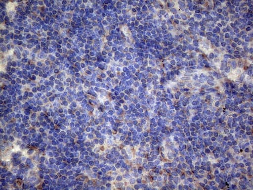 PAPSS2 Antibody (aa1-247, clone OTI6H10)