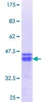 Human ClC-3 / CLCN3 Protein (Recombinant GST, N-terminus)