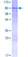 Human BPIFB4 / LPLUNC4 Protein (Recombinant GST)