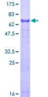 Human AHSG / Fetuin A Protein (Recombinant GST)