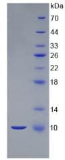 Mouse S100B / S100 Beta Protein (Recombinant His)