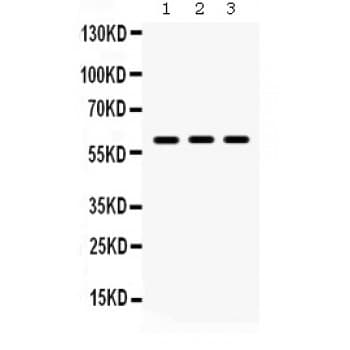 Lumican Antibody (aa68-338)