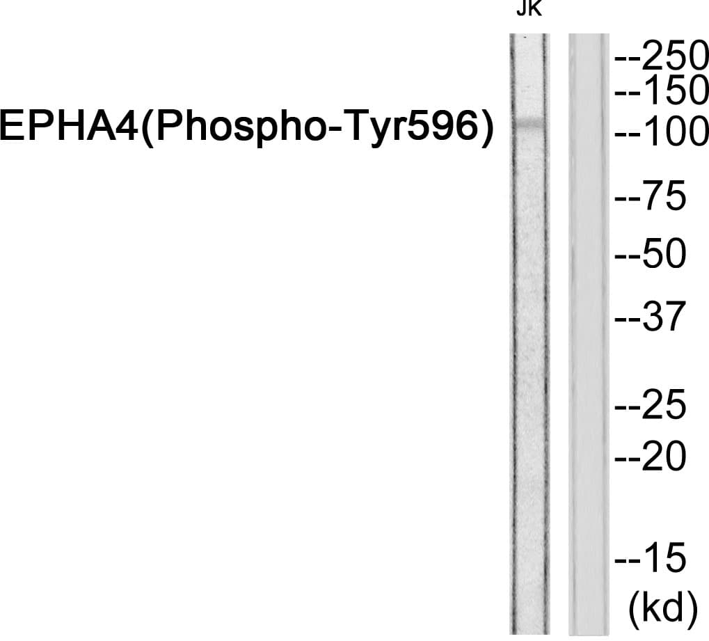 EPHA4 / EPH Receptor A4 Antibody (phospho-Tyr596)