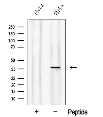 PIH1D1 Antibody