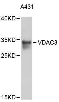 VDAC3 Antibody