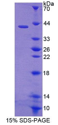 Human ERBB2 / HER2 Protein (Recombinant His, N-Terminal)