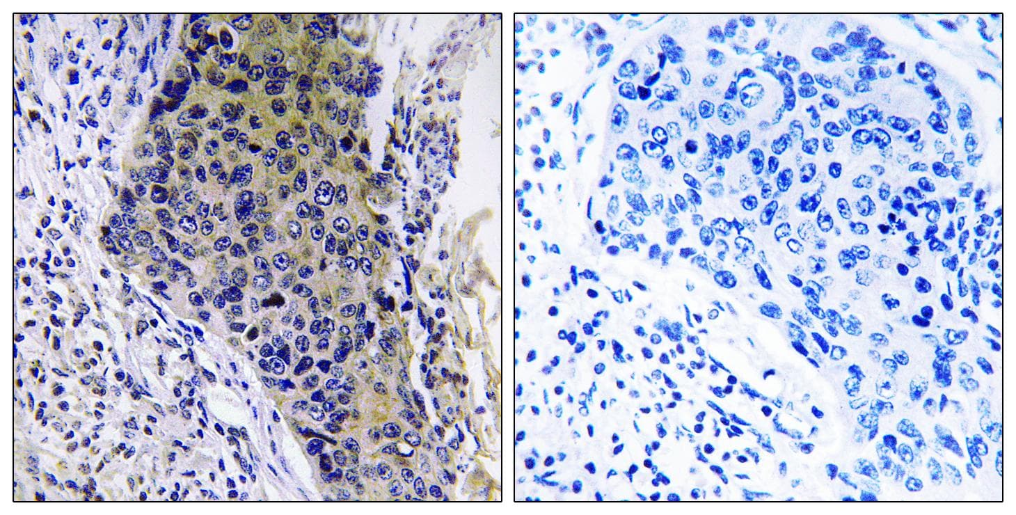 Polyclonal Rabbit anti-Human MRPL34 Antibody (IHC)