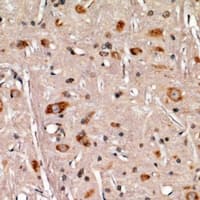 Polyclonal Rabbit anti-Human APCS / Serum Amyloid P / SAP Antibody (IHC, WB)