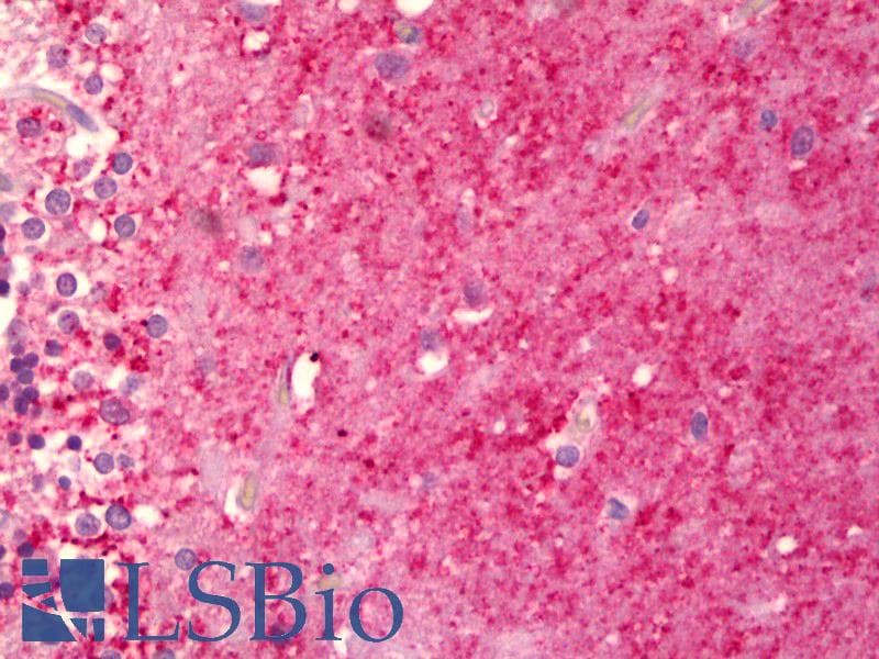 IHC-plus™ ENO2 / NSE Antibody (aa371-420)