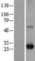RAB21 Protein (Over-Expression Lysate Myc-DDK (Flag))