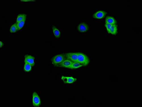 ZSWIM6 Antibody