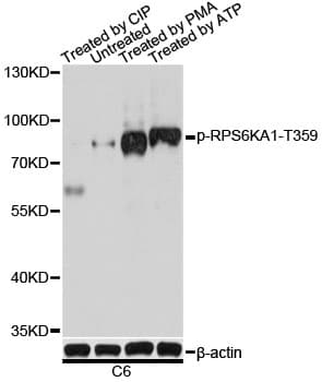 RPS6KA1 / RSK1 Antibody (phospho-Thr359)