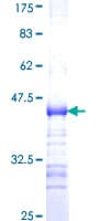 Human ADAMTS7 Protein (Recombinant GST, N-terminus)