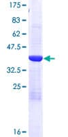 Human CRBPIV / RBP7 Protein (Recombinant GST)