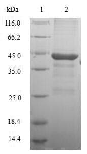 Human GC / Vitamin D-Binding Protein (Recombinant 6His, N-terminus)